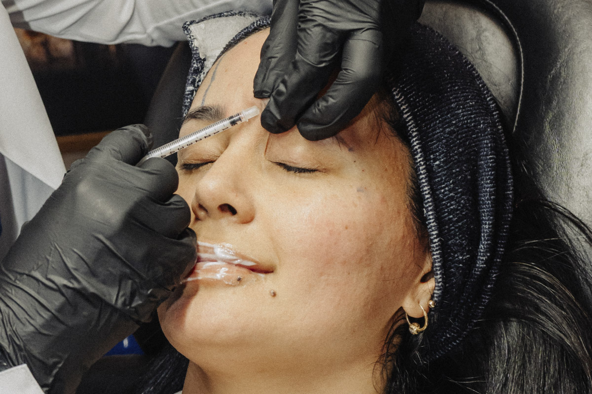 Botox Facial